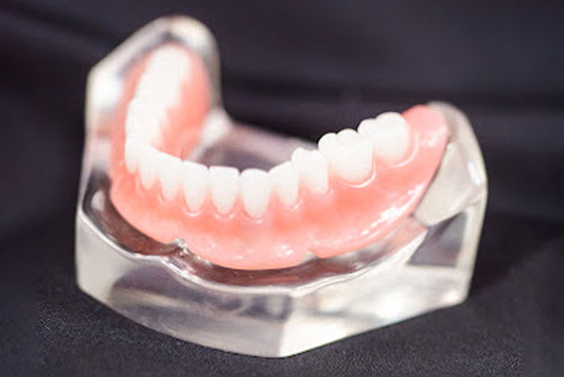 implant supported denture dr scruggs office